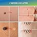 Evagloss Advanced Skin Tag Remover and Mole Remover Cream with Repair Gel -Remove Moles,Skin Tags and Dark Spots, See Results Fast
