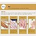 Mchoice Nail Treatment Essence Nail and Foot Whitening Toe Nail Fungus Removal