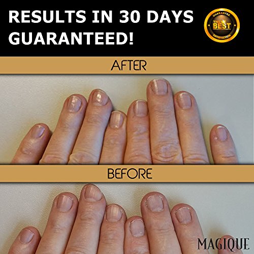 Nail Biting Treatment for Kids & Adults - Thumb Sucking Stop - No Bite Nail Polish - Thumb Guard for Thumb Sucking - Bitter Nail Polish - Nail Biter Stopper - Magique NoBite, 0.5 Fl Oz - Thumbnail 7