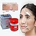 Skin Lightening Whitening Cream Spot Freckle Fade Removal Cream for Face Brightening Reducing Various Age Dark Spots Freckles Melasma +Fading Melanin