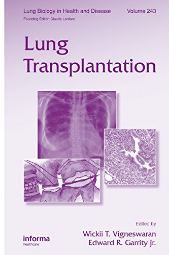 Lung Transplantation (Lung Biology in Health and Disease)
