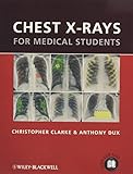 Chest X-rays for Medical Students