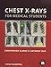 Chest X-rays for Medical Students