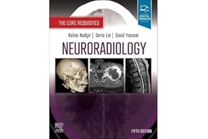 Neuroradiology: The Core Requisites