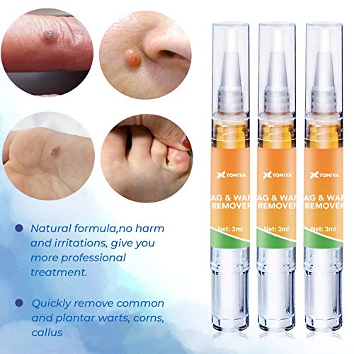 Tomiya Skin Tag Remover Wart Remover Quickly Remove Common And