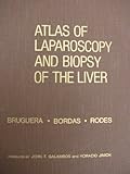 Image de Atlas of Laparoscopy and Biopsy of the Liver