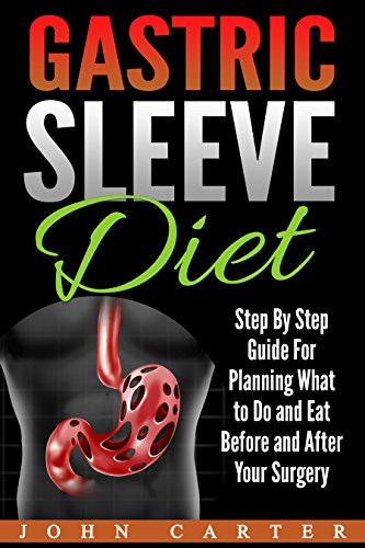 Gastric Sleeve Diet: Step By Step Guide For Planning What to Do and Eat Before and After Your Surgery (Gastric Sleeve Cookbook, Gastric Sleeve Recipes Book 2) (Best Over The Counter Period Medicine)