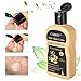 Anti-Hair Loss Shampoo, Hair Regrowth Shampoo, Natural Old Ginger Hair Care Shampoo Effective Solution for Hair Thinning & Breakage - Hair Regrowth Products for Men & Women