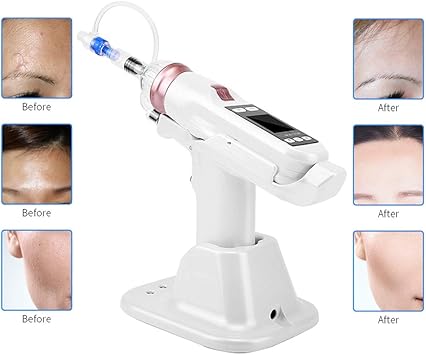 Amazon Co Jp ウォーターインジェクションメソセラピーガンez陰圧メソガンモイスチャライジングアンチリンクルフェイシャルスキンブライトニングビューティーウォーターインジェクターデバイス スポーツ アウトドア