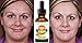 Todorganic Suero de Vitamina C - 20% Con Acido Hialuronico y Vitamina E, Repara Daño Solar, Líneas finas, Manchas de la Cara, Anti-Envejecimiento, Repara Las Ojeras, Anti-Arrugas, Cuidado de la Piel, El Mejor Suero ORGÁNICO 100% Natural, Tema Profesional 1 oz. Facial