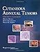 Cutaneous Adnexal Tumors