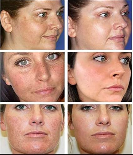 breylee vitamin c whitening cream