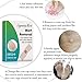 Wart Removal,Corn Callus Remover,Plantar Wart Remover, Foot Wart Remover, Common and Plantar Warts Treatmentthumb 3