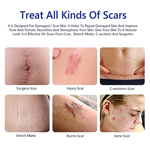 Scar Removal Cream,Advanced Scar Gel for Surgical and Acne Scars, Cuts