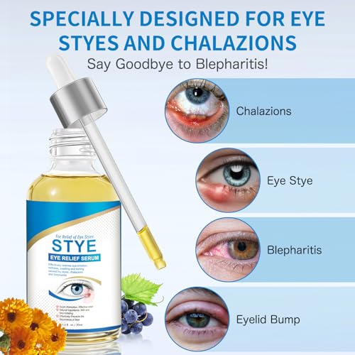 Stye Eye Treatment, Natural Stye Relief Serum for Chalazion, Blepharitis & Eyelid Bump, Gentle Soothing Eye Care for Swelling Redness Irritation (30 ml)