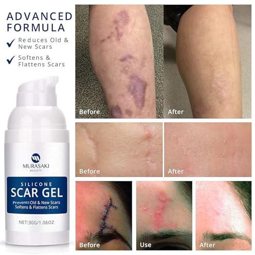 100% Silicone Scar Gel Scar Cream - Advanced Scar Gel for Surgical Scars, C-Section, Stretch Marks, Injury, Burns, Keloids, Old and New Scars