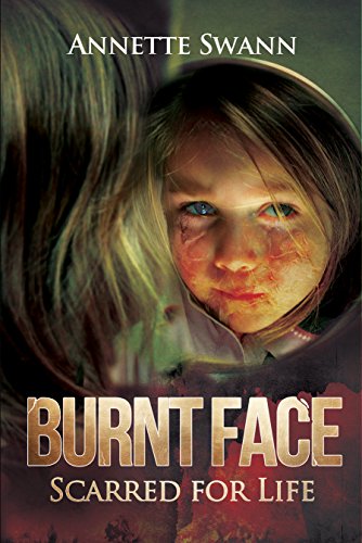 Burnt Face: Scarred for Life by [Swann, Annette]