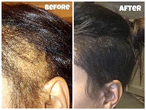 Silk Growth Oil with 6 Organic Essentials for Rapid Hair Growth, Shine, Strength, and Elasticity - Repairs, Balances pH, Prevents Breakage