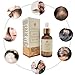 Hair Growth Serum,Hair Growth Treatment,Hair Serum,Hair Loss &Hair Thinning Treatment, Hair Growth Oil for Stronger, Thicker, Longer Hair(30ml)thumb 4