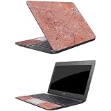 MightySkins Urban Camo Skin For HP Chromebook 11 (2018) 11.6" - Protective Vinyl Decal, Made In USA - View #2