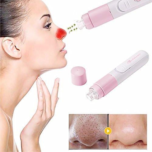 Xander Handheld Electric Vacuum Suction Face Cleaner Facia Blackhead Removal Skin Care Massage Cleaning Tool (Pink)
