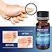 Wart Treatment, Wart Removal Treatment, Painless Removal of Plantar, Common Warts and Infections, Promotes The Healing of Calluses and Corns(10ml)thumb 1