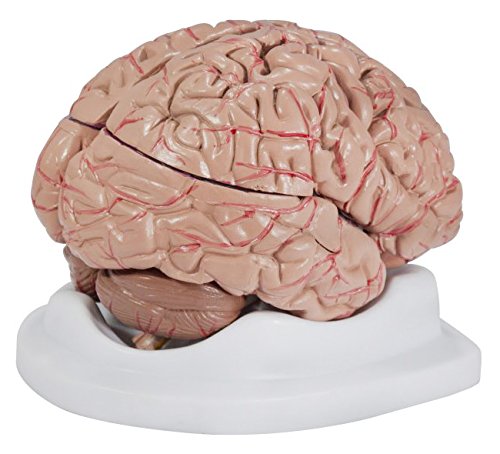 Budget Brain with Arteries Model