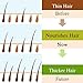 Skymore 30ml Fast Hair Growth Serum, Anti-Hair Loss, Hair Thinning Treatment, 100% Pure & Natural, Non-Greasy, Nourishing & Moisturizing, All Hair Types