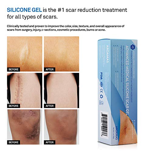 Aroamas Advanced Scar Gel Medical-Grade Silicone for Face, Body, Stretch Marks, C-Sections, Surgical, Burn, Acne, Old & New Scars, Clinically Proven, 30g - Thumbnail 3