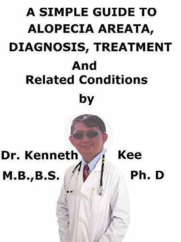 A Simple Guide To Alopecia Areata Diagnosis Treatment And