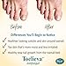 Toelieva Antifungal with Maximum Undecylenic Acid Fights Fungus Under/Around Toenails – 2 oz.thumb 2