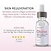 Lactic Acid 70% Gel Peel (Professional Chemical Peel ) AHA Facial Treatment – 1 fl oz. Ideal for Acne, Age Spots, Dark Spots, Hyperpigmentation, Wrinkles and Fine Lines