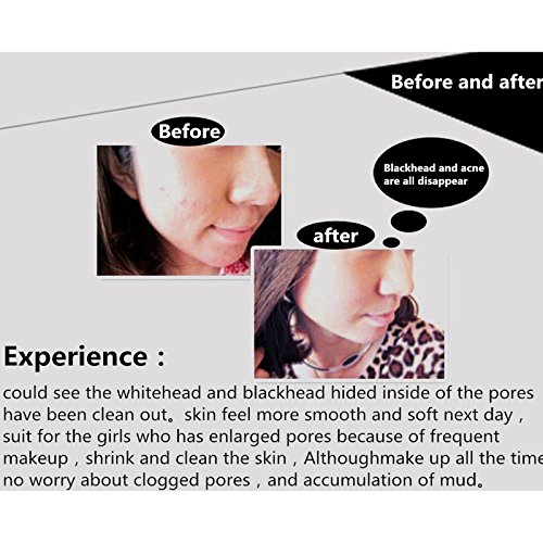 MY LITTLE BEAUTY Suction Black Mask Deep Cleansing Face Mask 