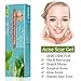 Acne Scar Remover, Acne scar treatment, Scar Removal, Scar Gel, Scar Remover Gel for Face Body, Old & New Scars from Cuts, Stretch Marks, C-Sections & Surgeries, Natural & Gentle