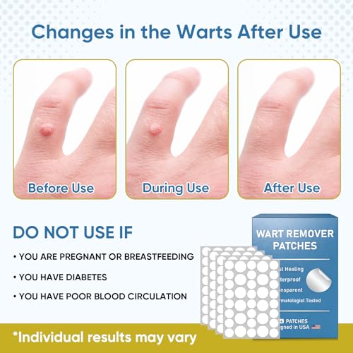 FEDOLOY Wart Remover Patches with 40% Max Strength Salicylic Acid, Hydrocolloid Adhesive Patches for Common & Plantar Warts, Skin Bump Care – Waterproof for Feet & Fingers,144 Patches