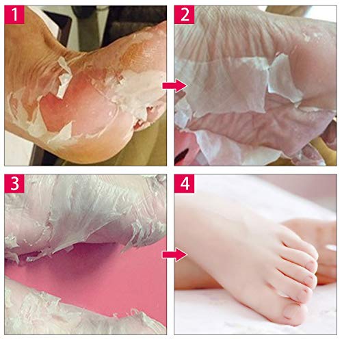 Foot Peel Mask, Y.F.M - 2 Pairs Foot Peeling Mask, Exfoliating Calluses and Dead Skin Remover,Repair Rough Heels, Get Soft Baby Foot,Lavender Scented,Completed in 2-7 days