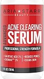 Aria Starr Anti Acne Treatment Serum & Pores Minimizer - BEST For Face, Stubborn Acne, Blackheads & Blemishes -1fl oz by AriaStarrBeauty