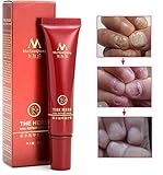 Nail Repair Cream Herbal Nail Fungus Treatment Onychomycosis Paronychia Anti Fungal
