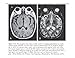 Ferri's Best Test: A Practical Guide to Clinical Laboratory Medicine and Diagnostic Imaging (Ferri's Medical Solutions)