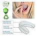 Mouth Guard for Grinding Teeth - 2 Pack, Made in USA, Thin and Trim Anti Grinding Night Guard - Teeth Whitening Dental Tray, Stops Bruxism - Teeth Clenching, No BPA