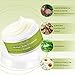 Acne Treatment, Acne Removal, Pimple Cream, Advanced Anti Acne Cream, Remove Acne, Repair Acne Natural/Quickly