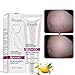 Enjoyment Scars Removal Cream Stretch Marks Cream Pregnancy Skin Care Belly Butter - Plant Nutrition Repair Ingredients to Help Prevent & Reduce Stretch Marks, 40G/1.4oz