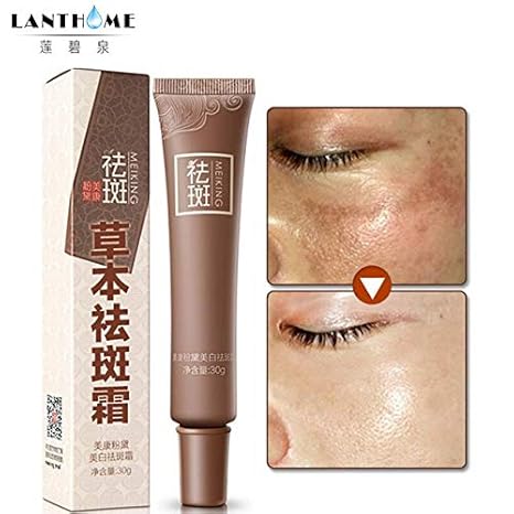 best black dots removal cream