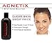 Acnetix - Acne Face Wash - Acne Facial Cleanser - 1 Step Acne Wash to Give You Clear Skin