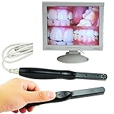 Zorvo Dental Intra Oral Camera 6 LED Mega Pixels Clear Image, Easy USB Connection,Works with Windows XP/Vista/7/8