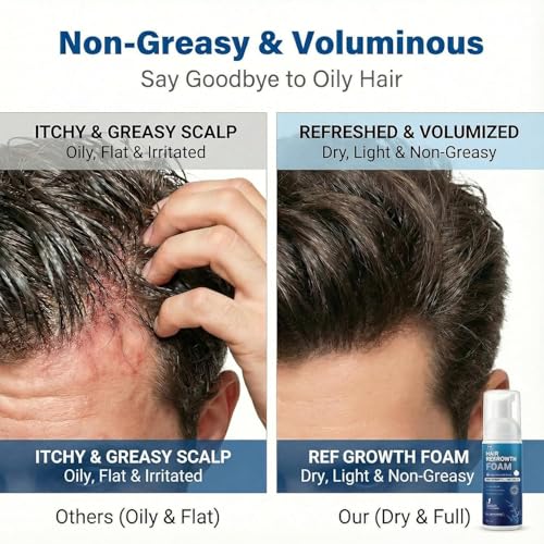 5% Minoxidil Foam for Men Women, 120ml 5% Minoxidil for Men Foam, Minoxidil for Women Hair Growth Suitable for Hair Thinning Receding Hairline and Hair Loss to Hair Regrowth Get Thicker Fuller Hair