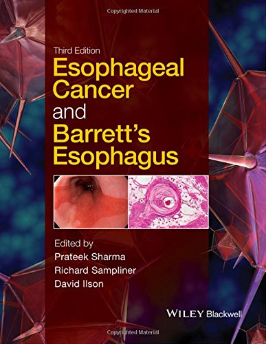 Esophageal Cancer and Barrett's Esophagus
