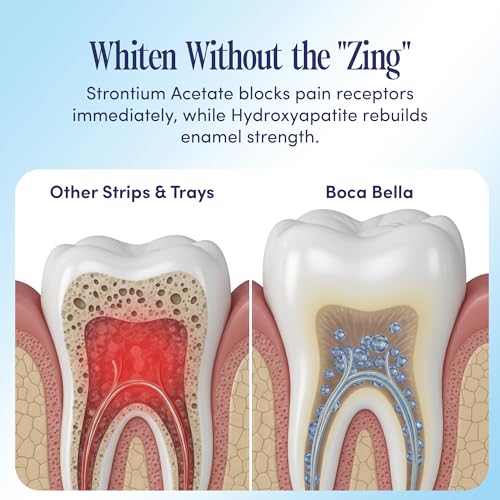 BocaBella Teeth Whitening Trays U-Wraps - 15% Hydrogen Peroxide Whitening Strips & Tray Alternative - Nano-Hydroxyapatite Enamel Safe - 10 Treatments - Up to 23 Shades Whiter - No Harsh Sensitivity