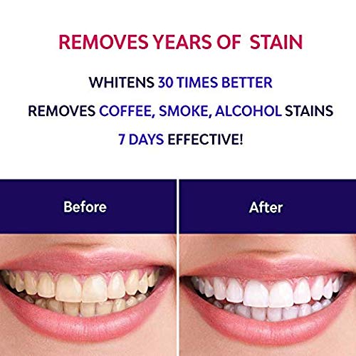 Teeth Whitening Pen (2 Pack), Safe 35% Carbamide Peroxide Gel, 20+ Uses, Effective, Painless, No Sensitivity, Travel-Friendly, Easy to Use, Beautiful White Smile, Natural Mint Flavor