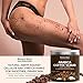 100% Natural Arabica Coffee Scrub, Best Stretch Mark, Acne & Anti Cellulite Treatment, Helps Reduce Spider Veins, Eczema, Age Spots & Varicose Veins - 12 Oz